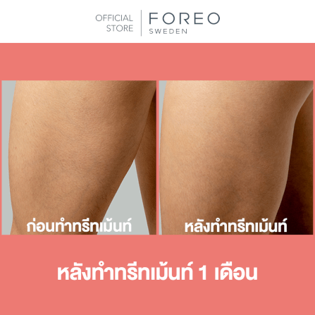 เครื่องกำจัดขน IPL FOREO PEACH2 Peach color_7
